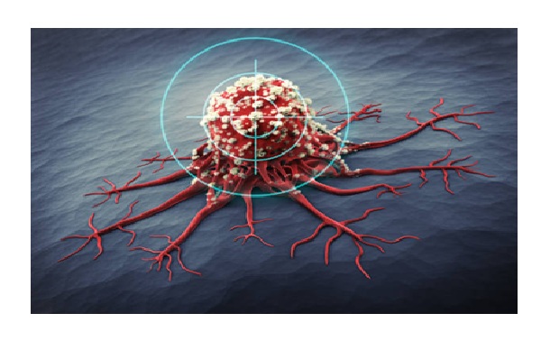 Cancer Definition and Overview: A Beginner’s Guide to Prevention and Treatment